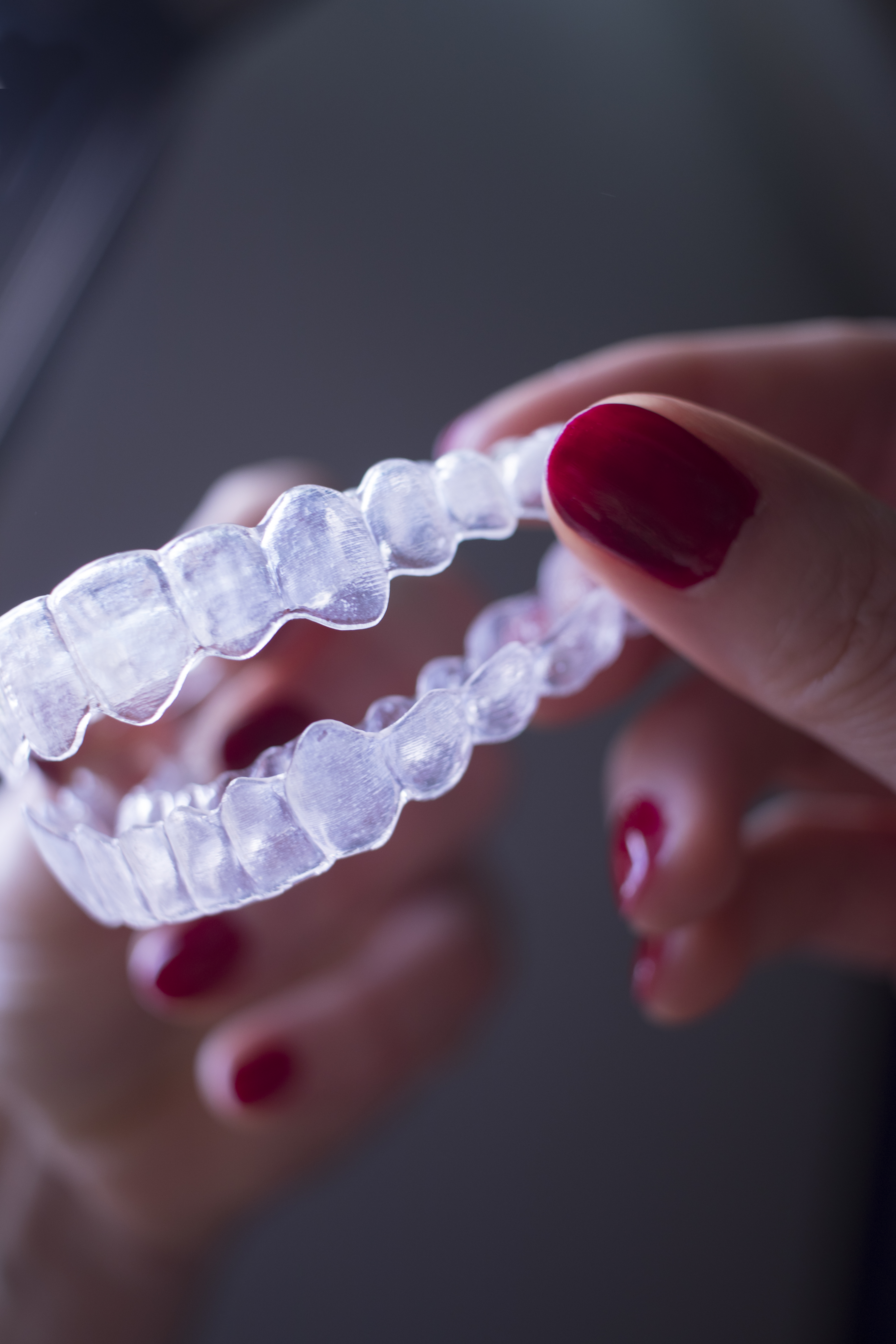NEXO3 aligner treatment