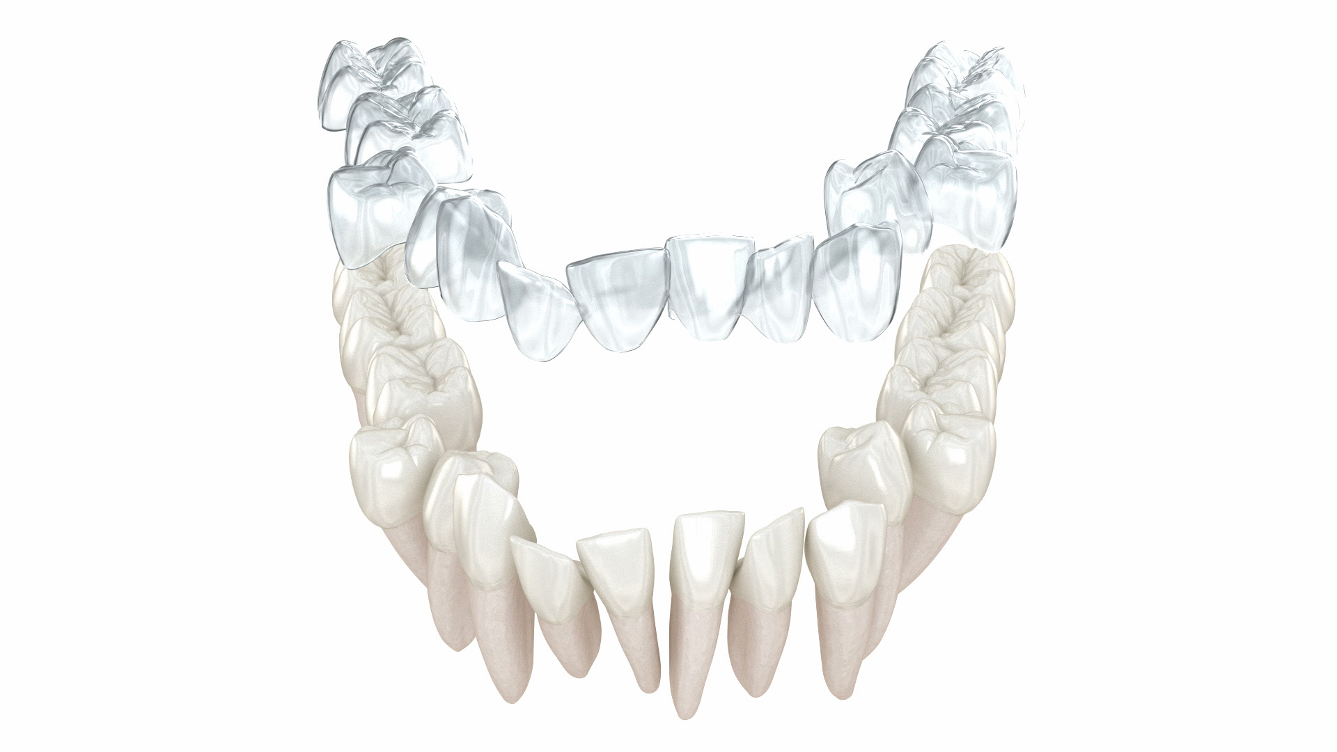Aligner Categories